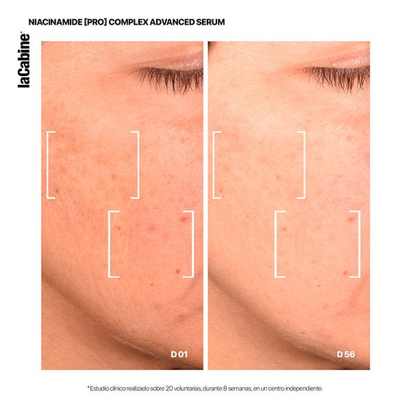 25% Niacinamide Complex