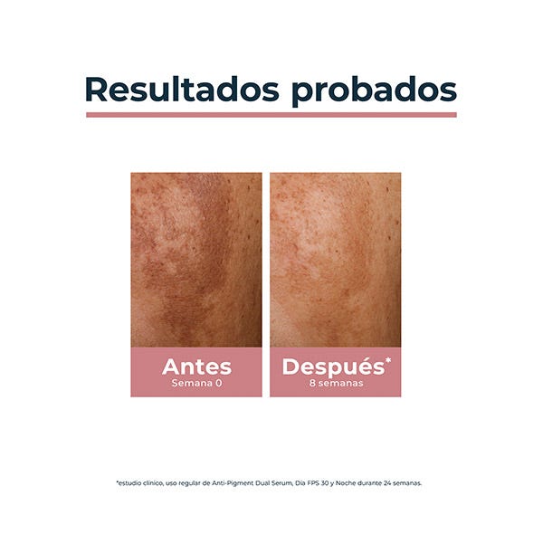 Anti-Pigment Dual Serum