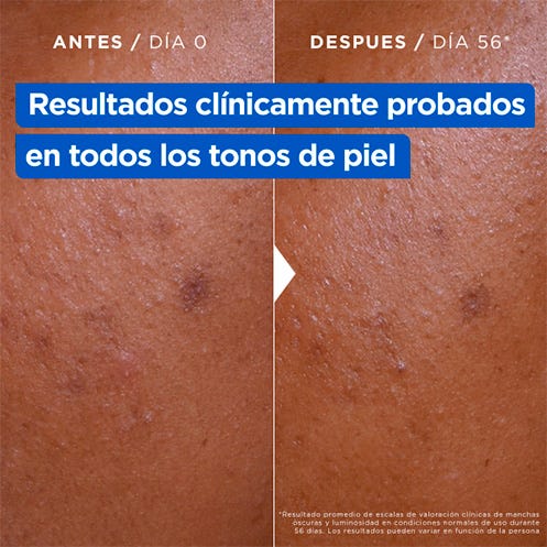 Crema Hidratante Anti-Manchas