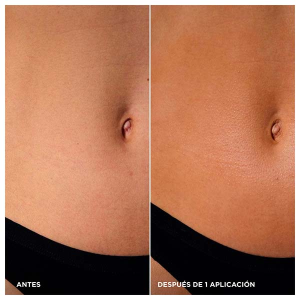 Gel Autobronceador