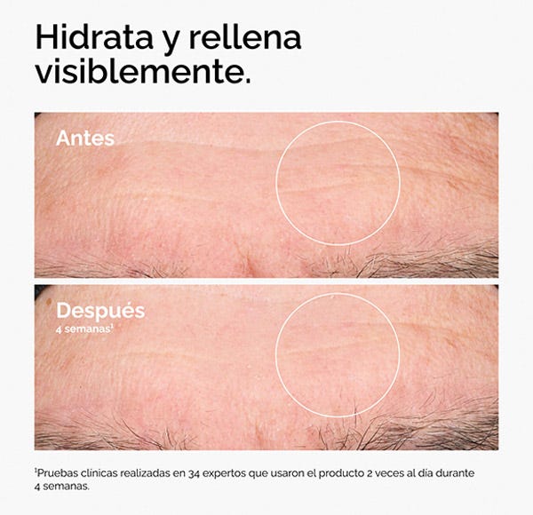 The Ordinary Hyaluronic Acid 2% + B5