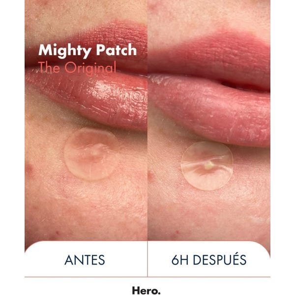 Hero Cosmetics Mighty Patch The Original