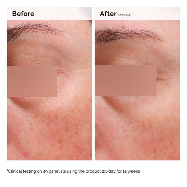 Niacinamide 5% Face And Body Emulsion