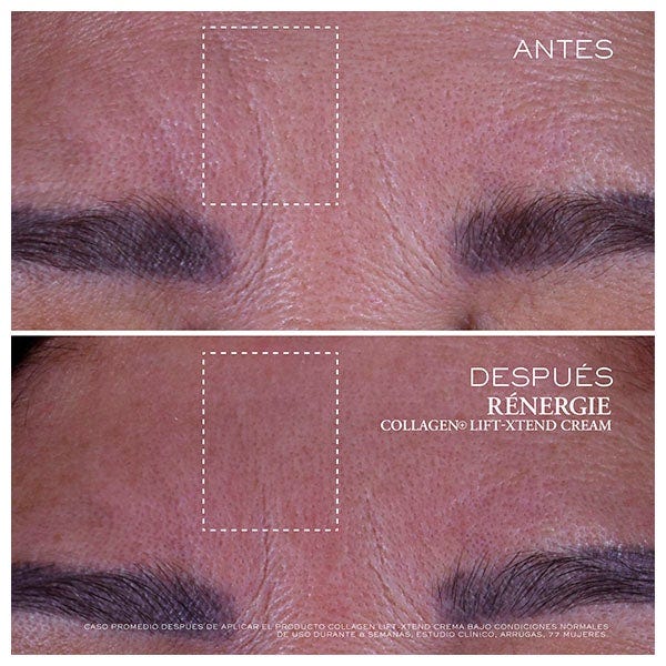 Rénergie Collagen Lift-Xtend Cream