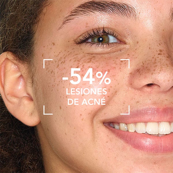 Bioderma Sébium Sensitive