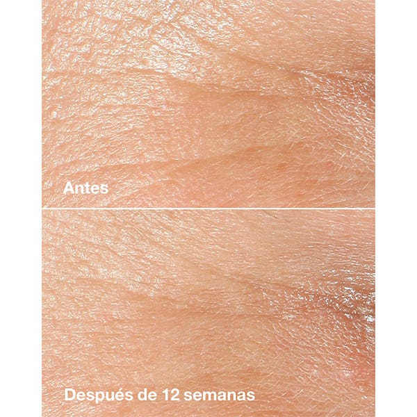 Clinique Smart Clinical Repair Wrinkle Correcting Cream