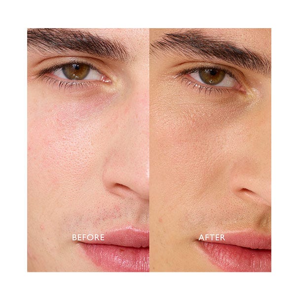 Sun-Kissed Face Drops