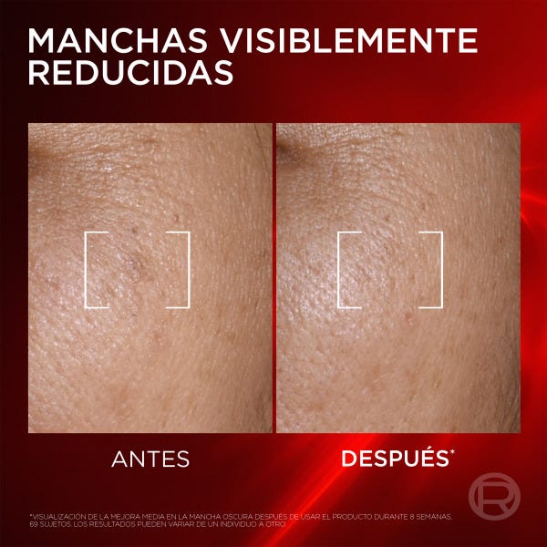 Triple Serum Antiedad Revitalift Laser