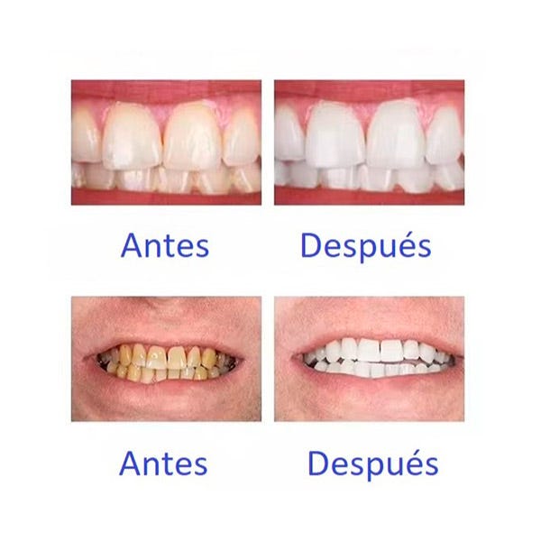 V34 Whitening Strips